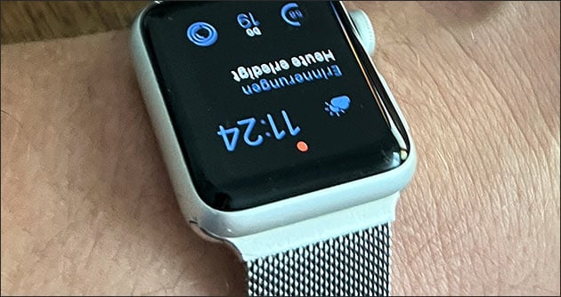 Apple Watch Display verdreht: Bildschirm drehen!